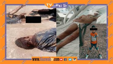 وجدة :  تهجم كلب يرسل طفل إلى العناية المركزة ببني وكيل