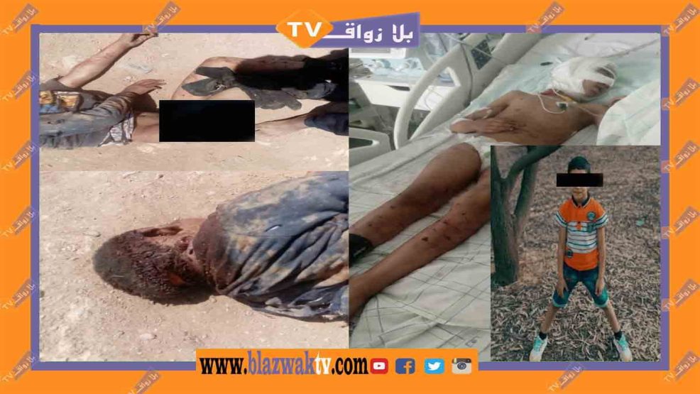 وجدة :  تهجم كلب يرسل طفل إلى العناية المركزة ببني وكيل