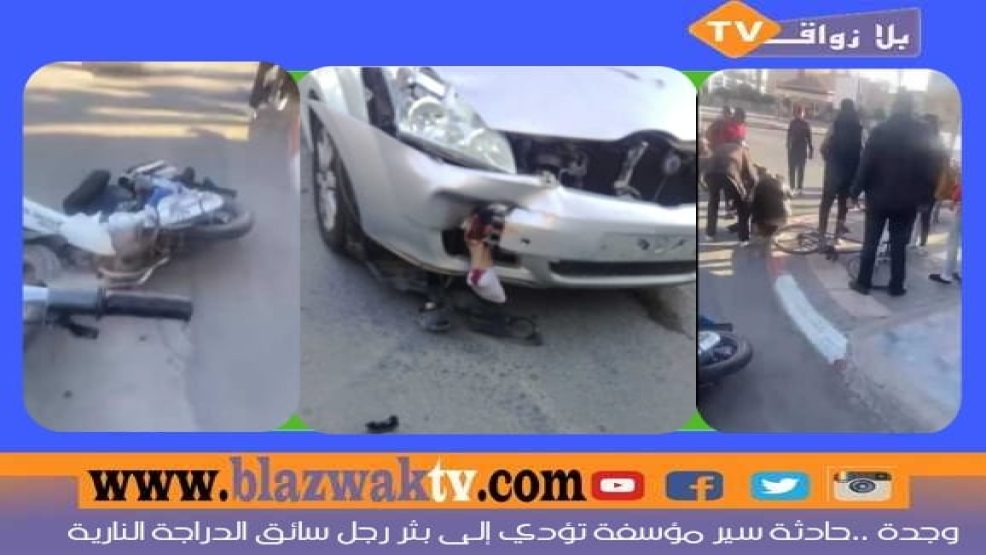 وجدة : حادثة سير تسبب في بثر ساق صاحب دراجة نارية