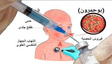 حملة وطنية للتلقيح ضد مرض بوحمرون (الحصبة)
