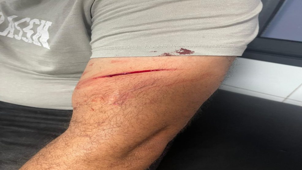 الولفة _الدارالبيضاء ..اعتداء جسدي و لفظي على رئيس اتحاد الملاك بحي الألفة.