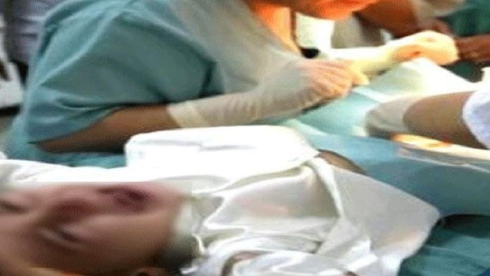 شفشاون..عملية ختان جماعية لأزيد من 20 طفلا تتحول إلى مأساة