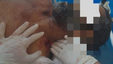 وجدة ..زنقة ابن عطية تكتسي بالدماء: شاب يعتقل إثر قتله رجلاً مضطرباً عقلياً!