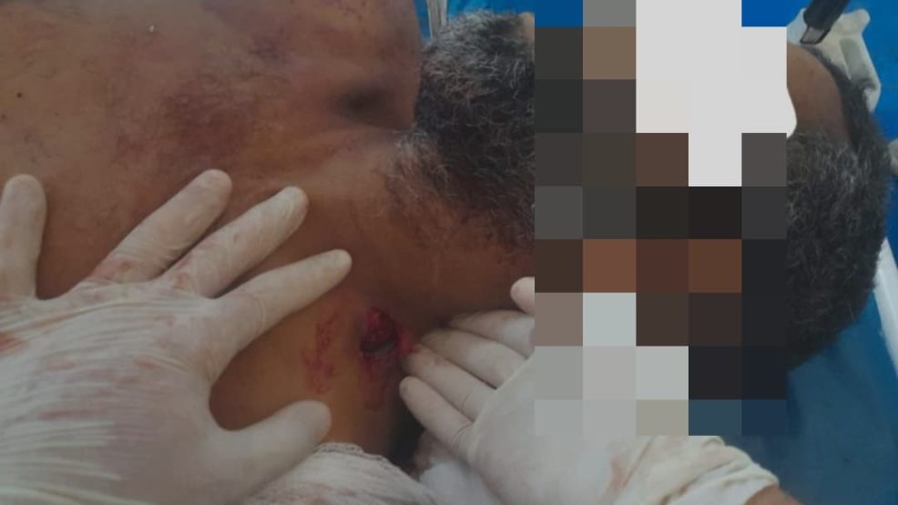 وجدة ..زنقة ابن عطية تكتسي بالدماء: شاب يعتقل إثر قتله رجلاً مضطرباً عقلياً!