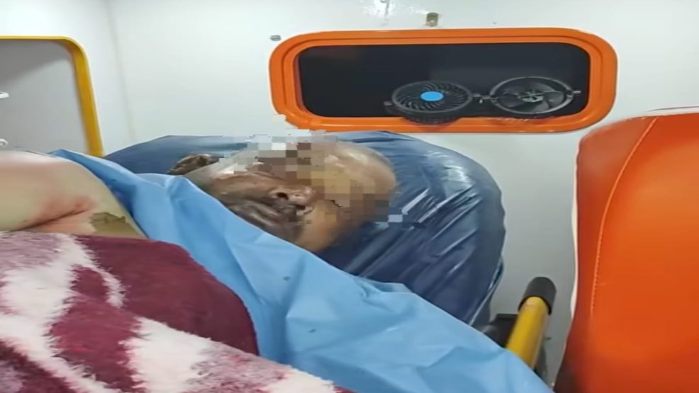 الجديدة..وفاة زهير بعد إضرام النار في جسده بسيدي بوزيد تعيد الجدل حول توزيع الأكشاك