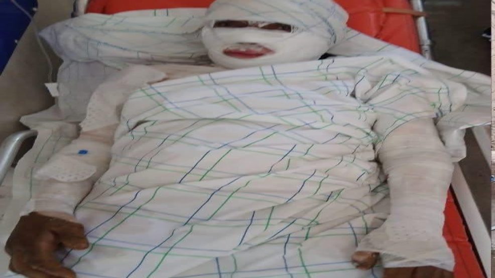 مأساة تهز جماعة غريس العلوي بإقليم الرشيدية.. سيدة تحرق جسدها احتجاجاً على توقيف أشغال بناء منزلها